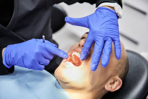 Best Emergency Dental Care for Sports Injuries in Silver City, NM