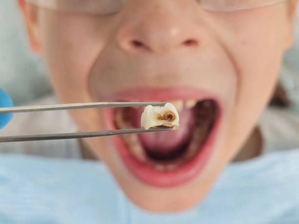 Best Emergency Pediatric Dental Care in Silver City, NM